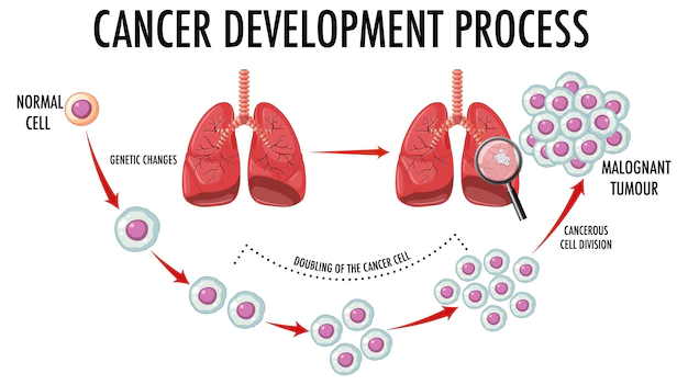 Free Vector | Diagram showing cancer development process