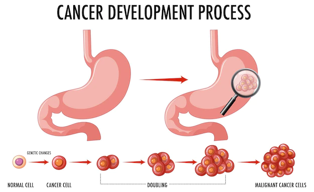 Free Vector | Diagram showing cancer development process