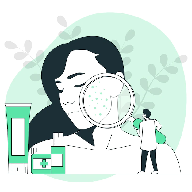 Free Vector | Acne treatment concept illustration
