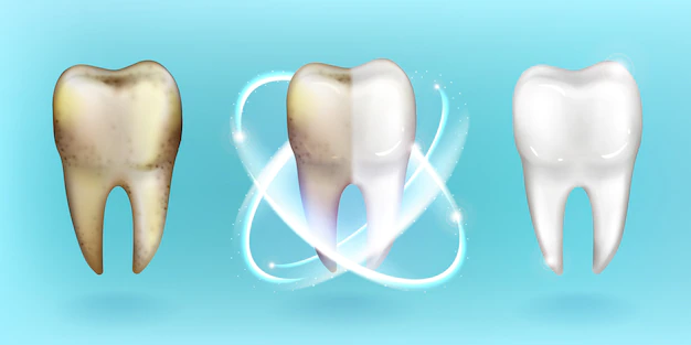 Free Vector | Clean and dirty tooth, whitening or clearing teeth