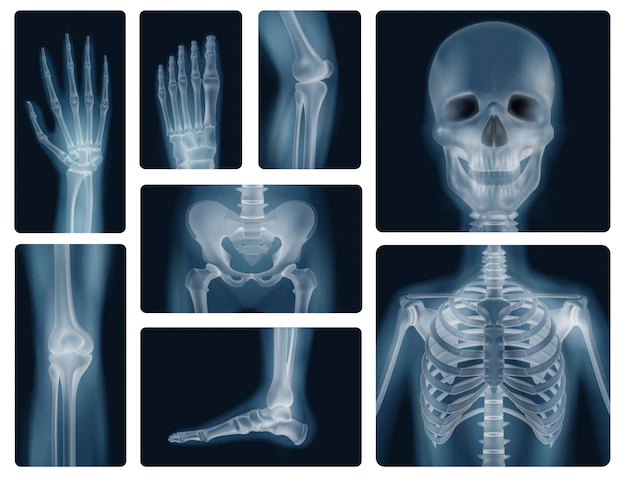 Free Vector | Human bones realistic x-ray shots
