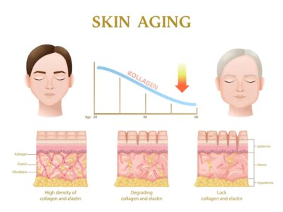 Free Vector | Skin aging process anatomy of layers during decrease of collagen level realistic infographics vector illustration