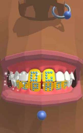 Dentist-Bling-3