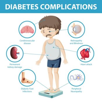 Free Vector | Diabetes complications information infographic