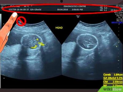 Reading Ultrasound Images with Confidence