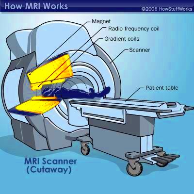 How MRI Works  Diagnostic imaging Mri Radiology