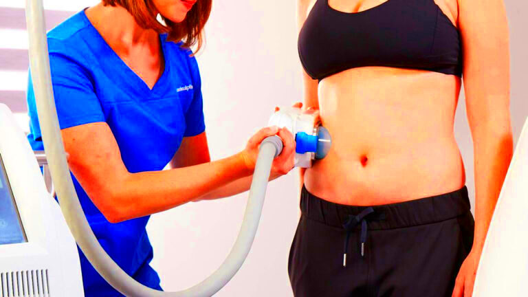 How Much Does CoolSculpting Cost at Ideal Image The Price You Should